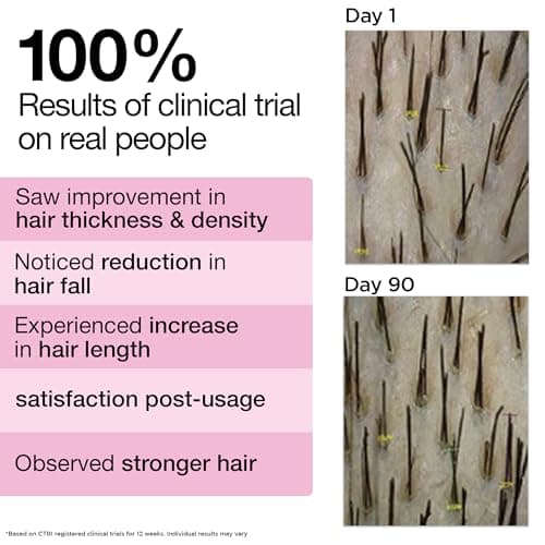 Soulflower Rosemary Hair Growth Oil, Hair Fall Control, Healthy Scalp, Strong Hair, Rosemary, Lavender, Castor|100% Pure, Natural, Organic, Clinically Proven for Hair Growth, 225ml 5
