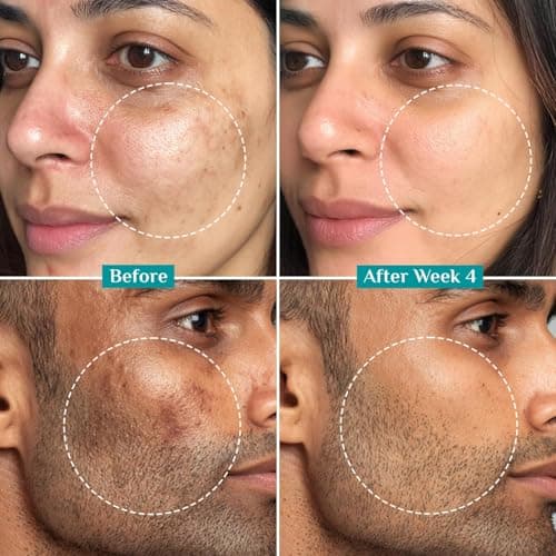Pilgrim 15% Vitamin C Serum 20 ml for Glowing Skin with Ferulic Acid & Kakadu Plum | Advanced Dark Spot Corrector, Hyperpigmentation & Brightening Face Serum | For All, Combination, Normal Skin 3