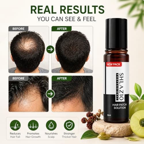 Shlazio Professional Hair Patch Solution | Alopecia Treatment | Promotes Natural Hair Regrowth | Anti-Hair Loss Formula | 10ml 4