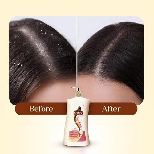 Meera Anti Dandruff Shampoo, With Goodness Of Small Onion and Fenugreek, For Men And Women, 1L 4