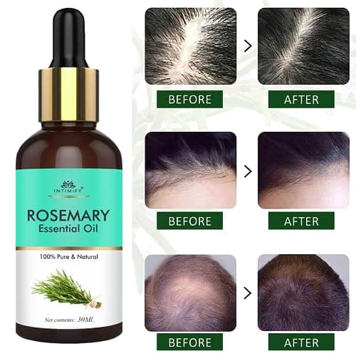 INTIMIFY Rosemary Essential Oil For Hair Growth for Women & Men | Reduce Acne| Moisturize Skin | For All Skin & Hair Types (30 ml) 3