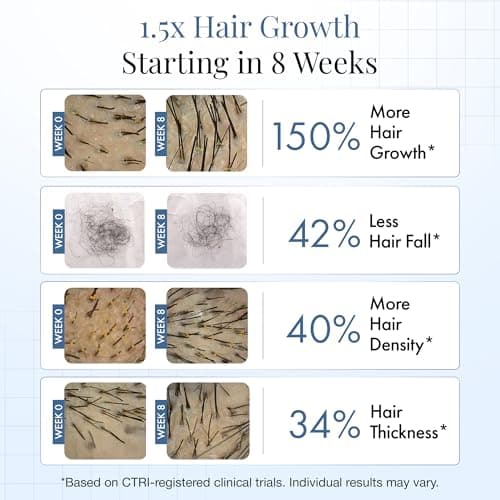 ThriveCo Hair Growth Serum For Scalp, 50ml |Advanced Patent Filed Clinically Proven Scalp Treatment for Hair Fall Control & Regrowth | British Medical Publication | Redensyl, Anagain, Regendil®, Rosem 3