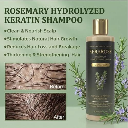 Rosemary Growth Support Shampoo | Strengthens Roots & Supports Hair Growth | Reduces Hair Fall & Nourishes Scalp | Suitable for All Hair Types (Pack Of 2) 2